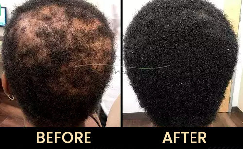 Thick & Bloom Hair Tonic